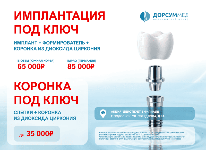 Имплантация зубов под ключ в Подольске