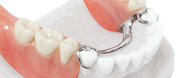 протезирование зубов в Жуковском